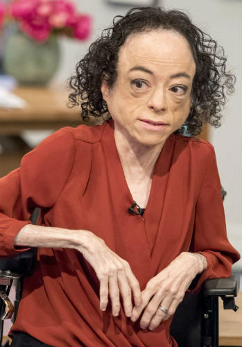 Liz Carr